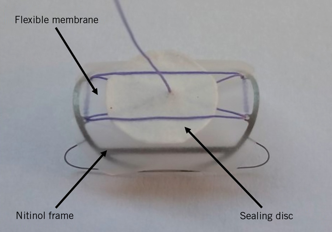 Dual ProGlide versus ProGlide and FemoSeal for vascular access haemostasis  after transcatheter aortic valve implantation