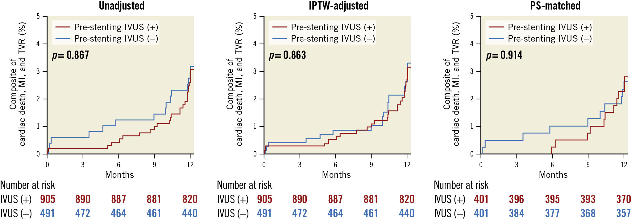 Figure 3. Kaplan-Meier survival curves for the clinical outcomes after one year. IPTW: inverse probability of treatment weighting; IVUS: intravascular ultrasound; MI: myocardial infarction; PS: propensity score; TVR: target vessel revascularisation