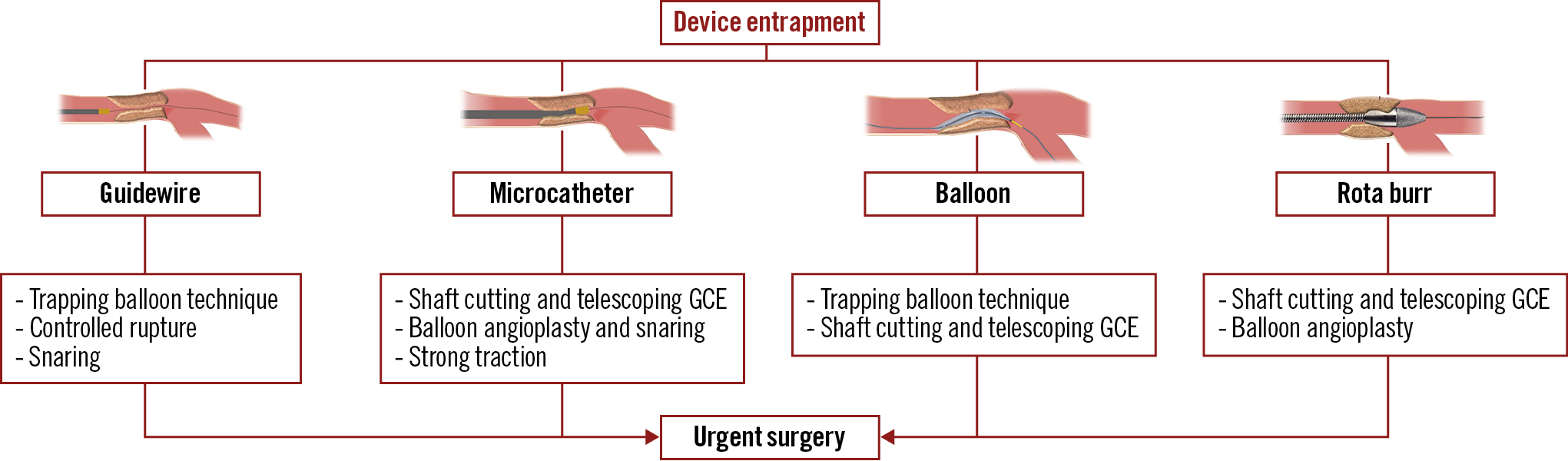 Figure 1. Techniques used for the management of device entrapment. GCE: guide catheter extension