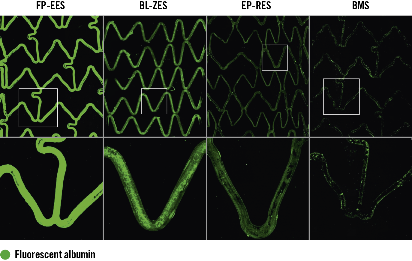 Figure 3. Representative confocal microscopic images using fluorescent human serum albumin in the flow loop model. The low (upper) and high (lower) power images show the stent surface fully covered by an obvious strong signal of fluorescent albumin in FP-EES. On the other hand, although BL-ZES and EP-RES also showed near complete coverage by albumin, the albumin signals (green) on the surface in BL-ZES and EP-RES were less intense relative to FP-EES. Minimal albumin signal was observed in BMS.