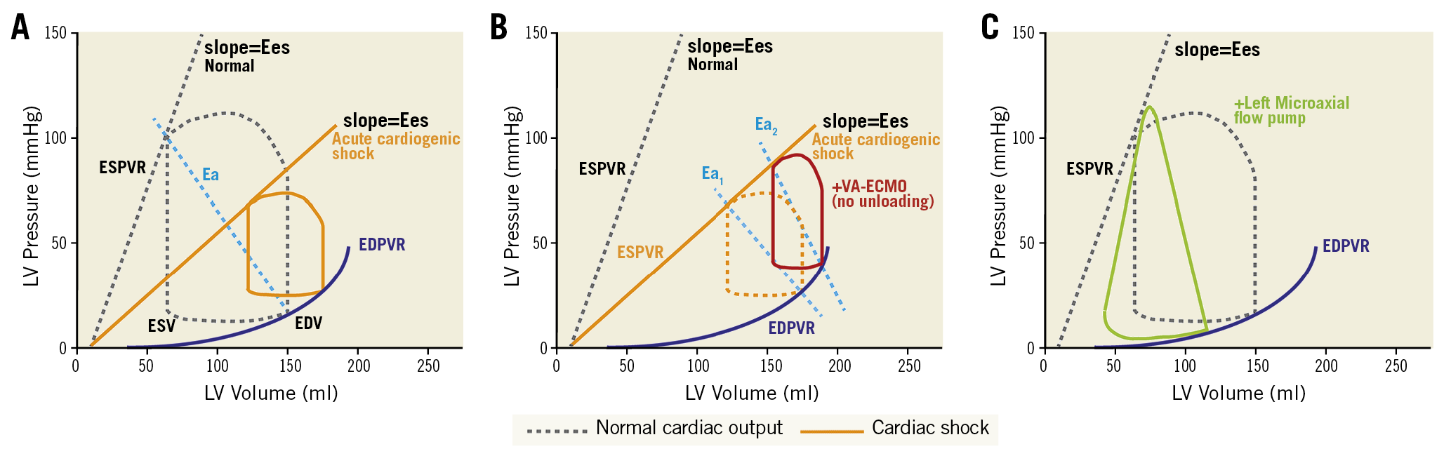 Figure 1. Pressure-volume loops. (A) Normal PV-loop and PV-loop in acute cardiogenic shock, the slope (Ees) shifts with changes in contractility. (B) PV-loop in VA-ECMO supported cardiogenic shock. PV-loop becomes narrower and is associated with an increase in EDPVR. (C) PV-loop in a left ventricular microaxial flow pump supported configuration, resulting in loss of normal isovolumetric periods, reduced EDPVR and conversion of the typical PV-loop to a triangular shape. Ea: arterial elastance; EDPVR: end-diastolic pressure-volume relationship; EDPVR: end-diastolic pressure-volume relationship; EDV: end-diastolic volume; Ees: end-systolic elastance; ESPVR: end-systolic pressure-volume relationship; ESV: end-systolic volume