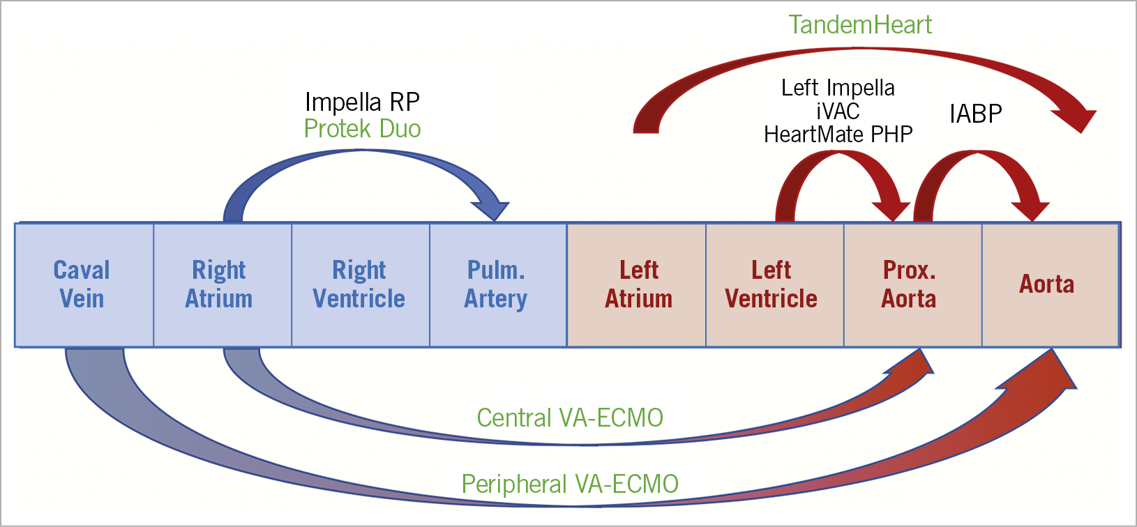 Figure 2. Different options for pVAD. Arrows indicate which part of the circulation is supported by the pVAD-modality. Devices in green can add blood oxygenation next to mechanical support. IABP: intra-aortic balloon pump; VA-ECMO: veno-arterial extracorporeal membrane oxygenation