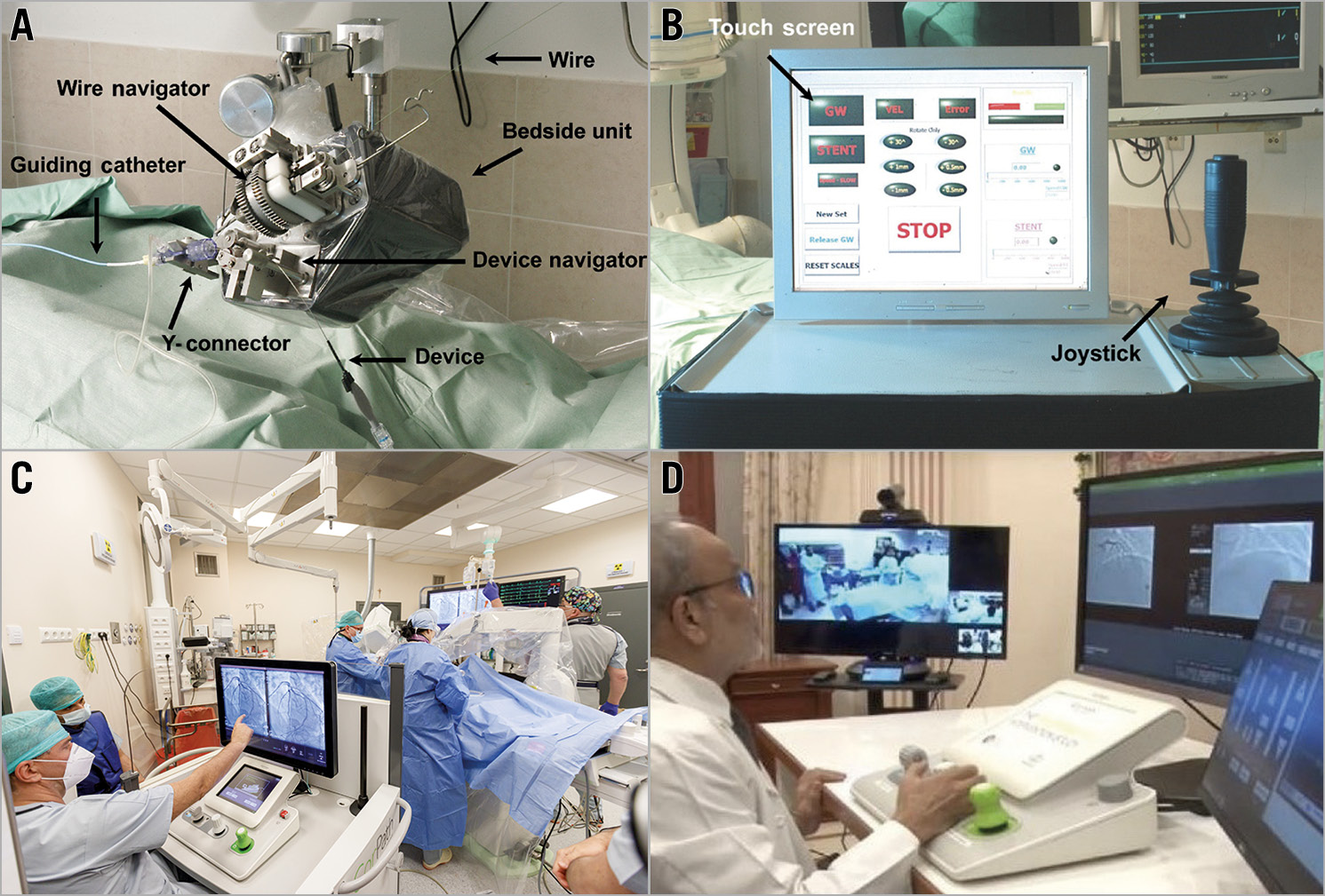 Figure 3. The evolution of the robotic PCI system and concept. A) The original Remote Navigation System manipulating wire and device are controlled at the console by a joystick (B). Reprinted from Beyar et al55, with permission from Elsevier. C) The current CorPath GRX control station60 is positioned within a shielded cockpit in the catheterisation laboratory with the operator console controlling the wire, the device, and the guide catheter (taken during robotic PCI at the Interventional Cardiology Center, Jagiellonian University Hospital, Poland). D) Set-up for the first remote catheterisation performed by Dr Tejas Patel in Ahmadabad, India. The control station is located 35 km away from the catheterisation laboratory, with the robotic arm at the patient side. The video of the patient room and the monitor screen are transmitted via the internet. From Patel et al79 [CC BY-NC-ND 4.0].