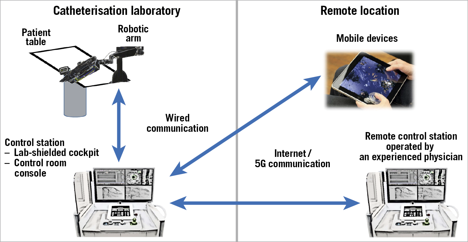 Figure 4. Local and remote schematics. The robotic arm, located in the catheterisation laboratory, is hard-wired to the control station, which can be placed either in the catheterisation laboratory or in the control room, according to the operator’s preference. A second remote control unit, which can also be installed on a mobile device, is connected through the internet or a 5G wireless connection and can be placed in any other location (i.e., either elsewhere in the same or a different hospital, or any location worldwide).