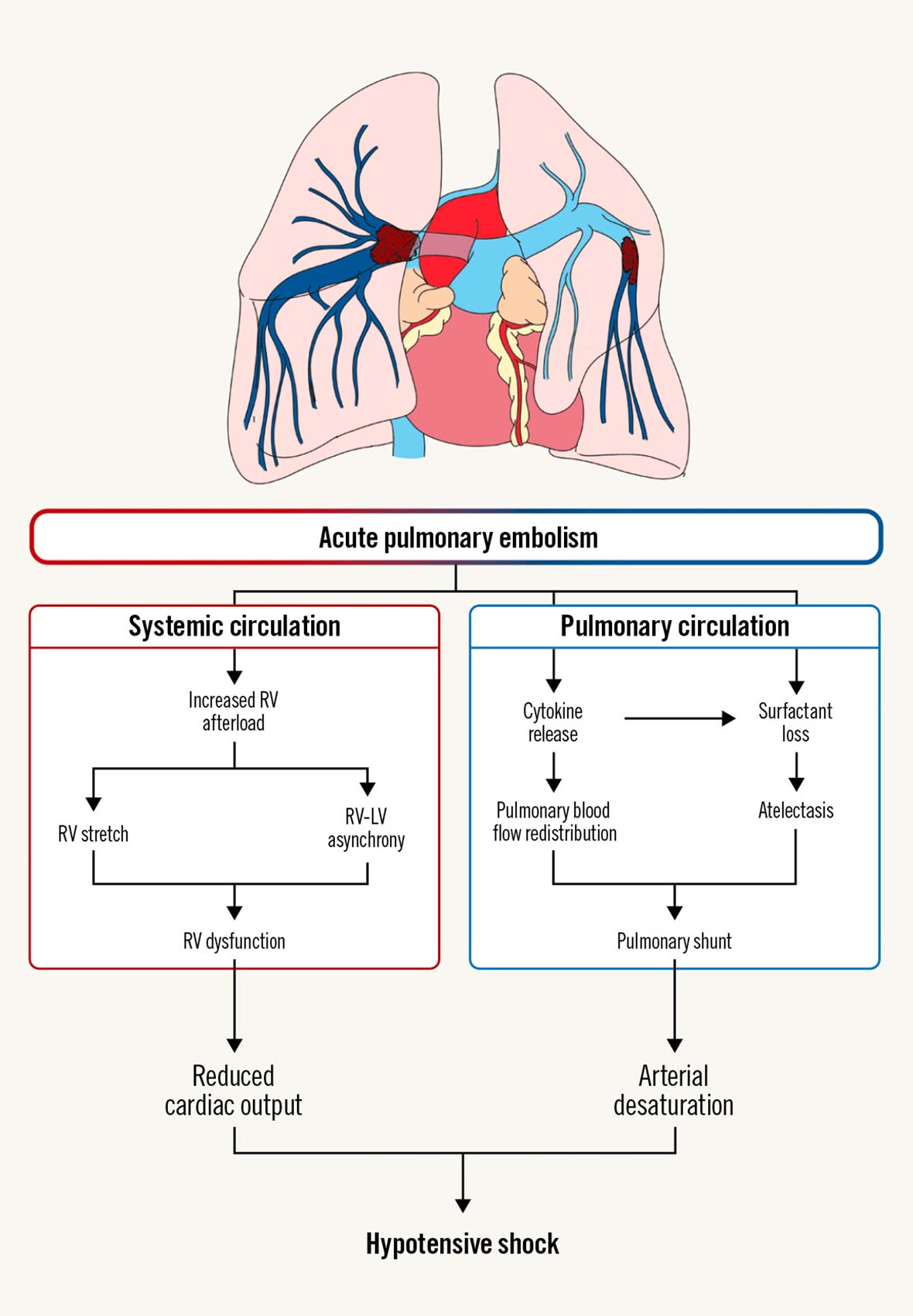 Percutaneous interventions for pulmonary embolism