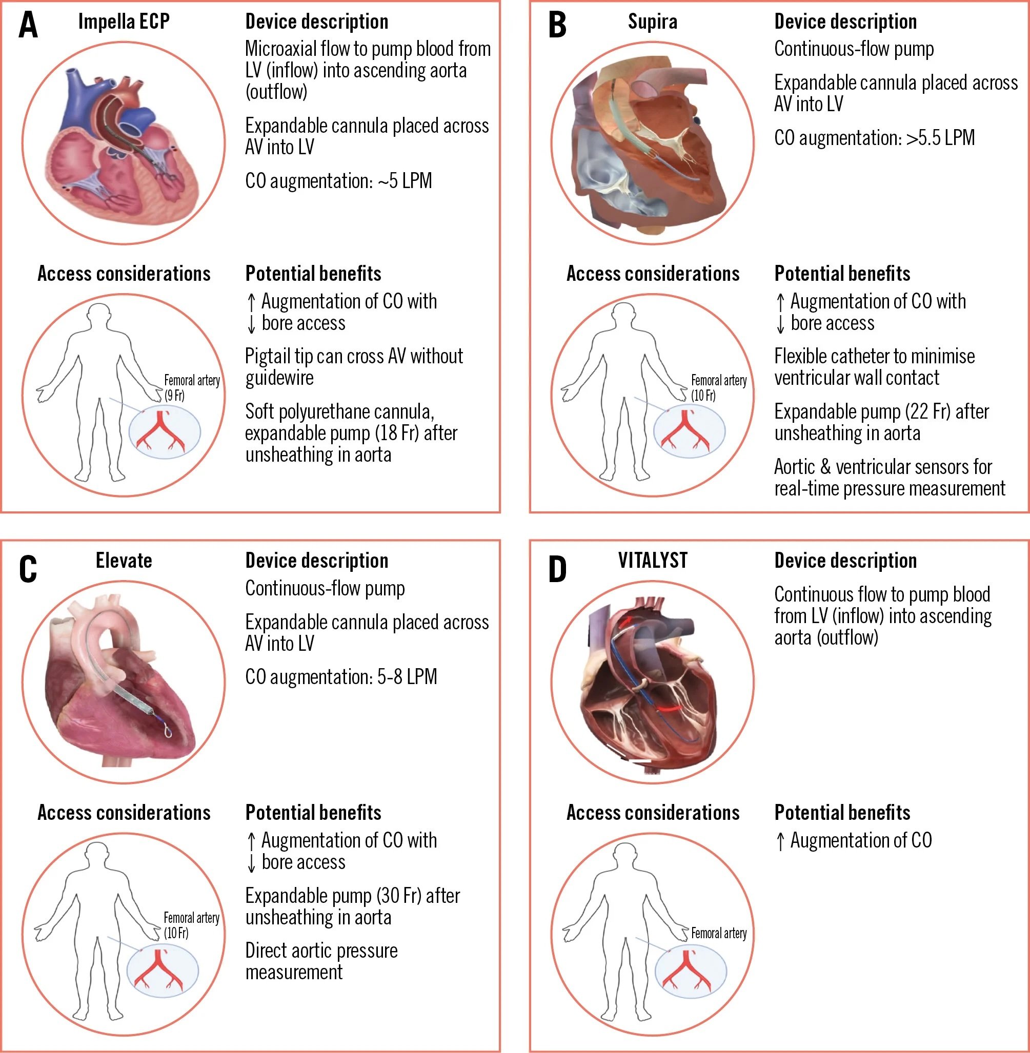 High-risk PCI with mechanical circulatory support