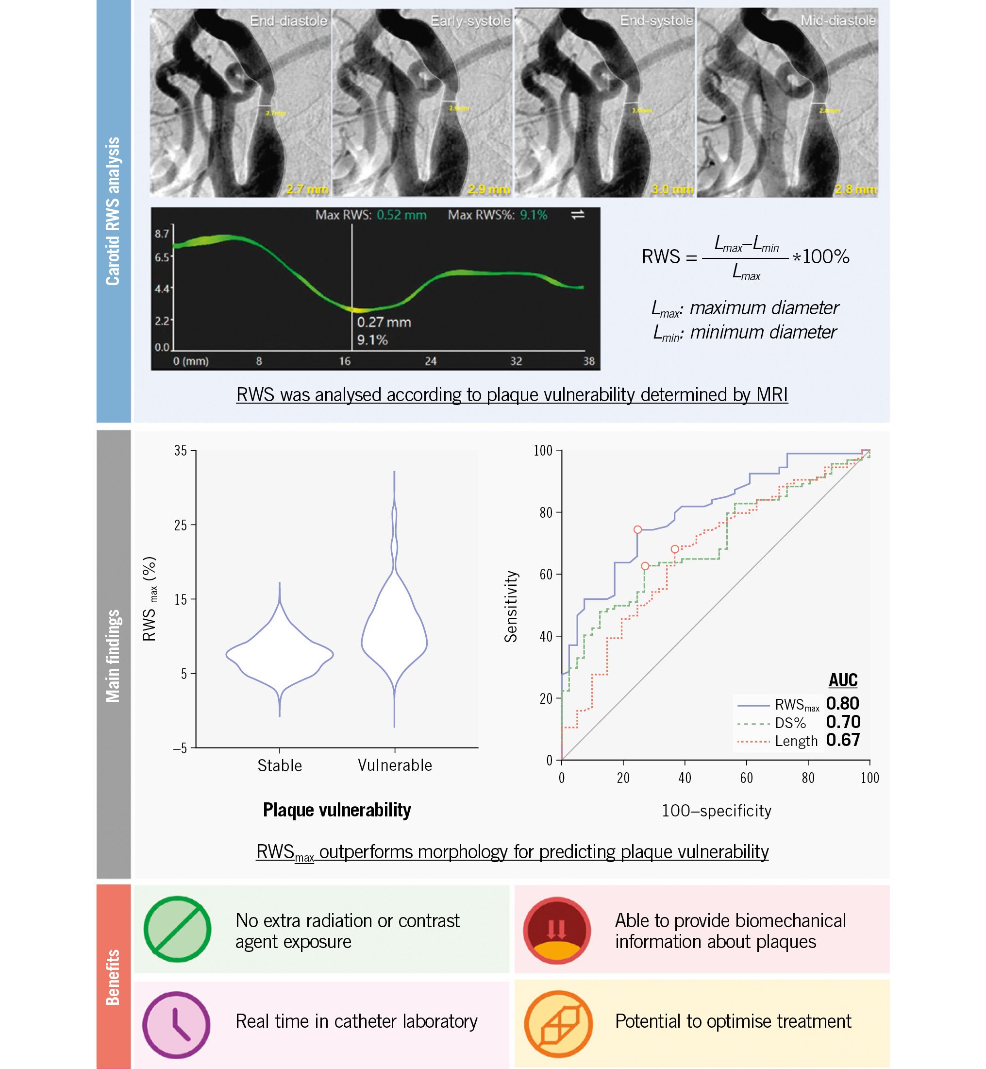 Radial wall strain in carotid plaques