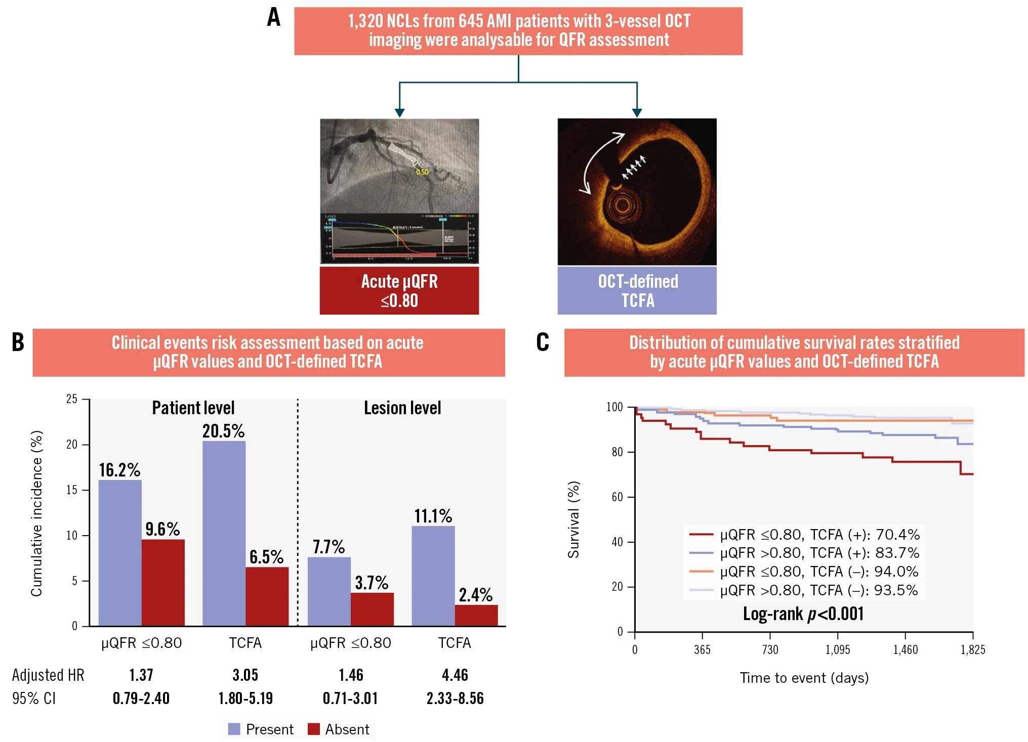 OCT outperforms μQFR in AMI prognostic value