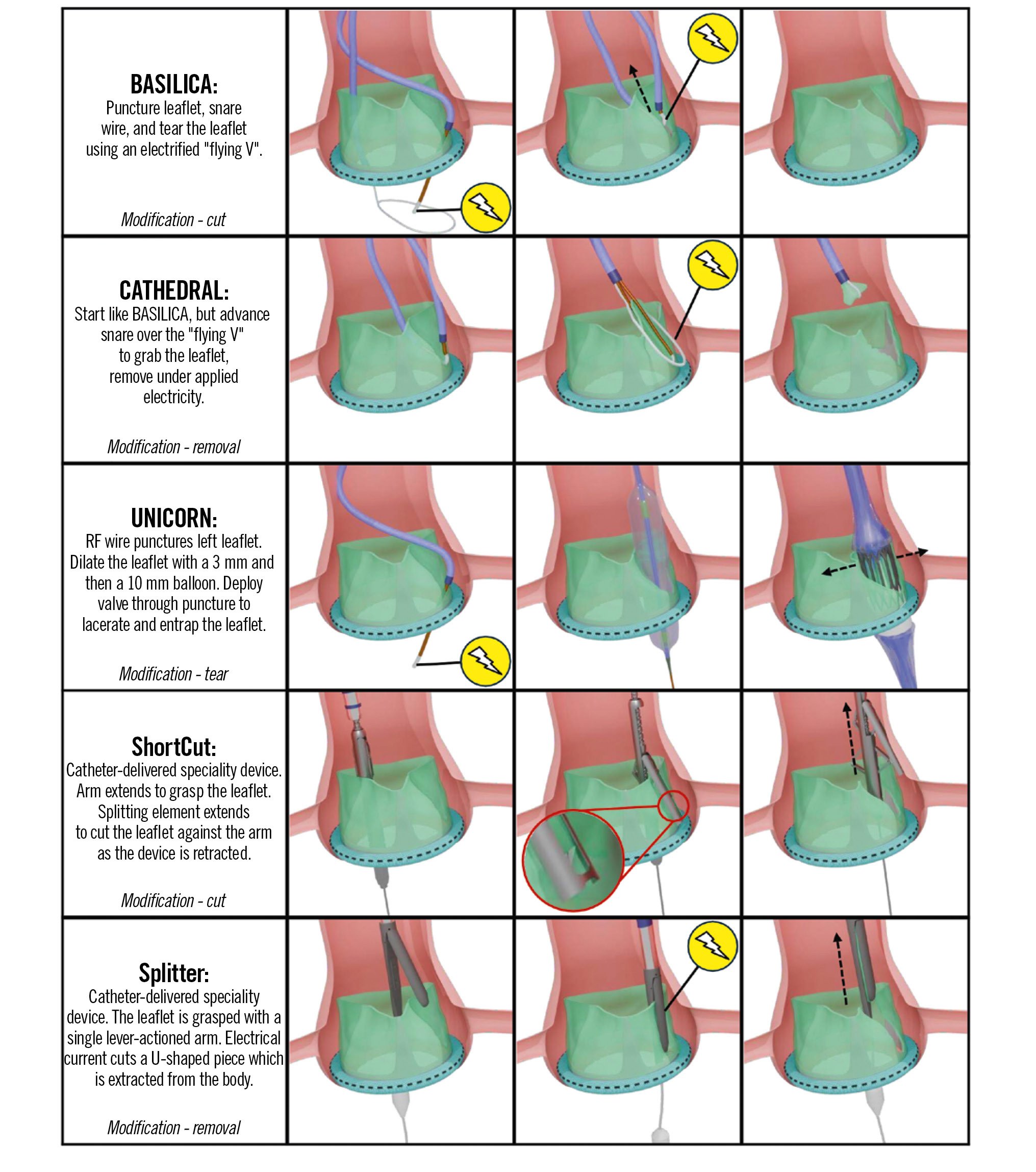 Leaflet modification techniques during TAVI