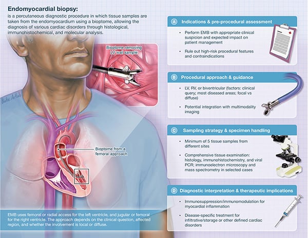 A new issue of EuroIntervention