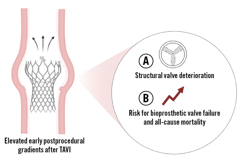 Residual MPG after TAVI