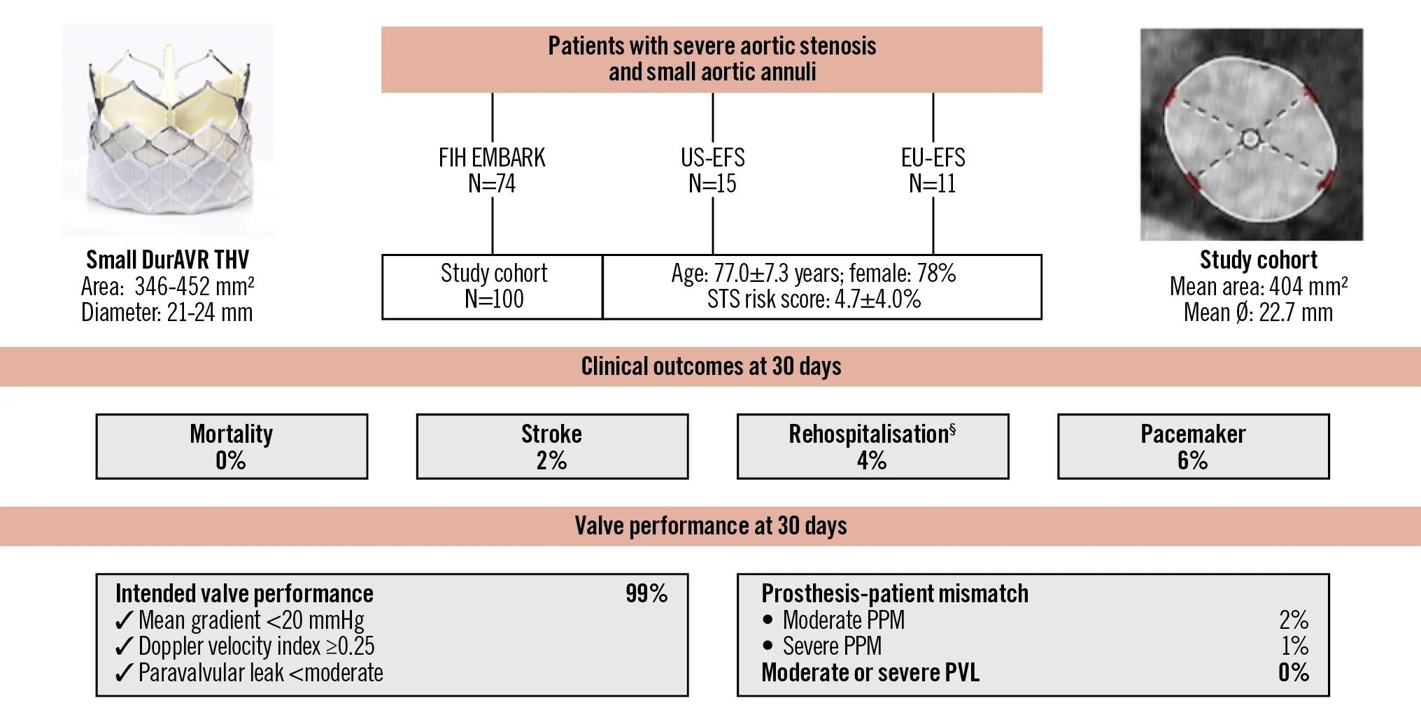 Biomimetic balloon-expandable THV in SAA