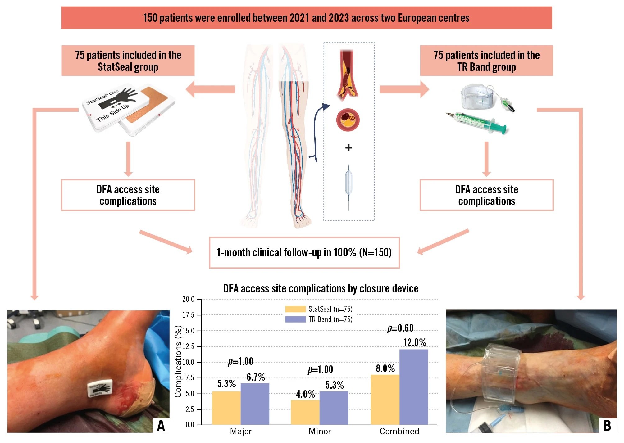 DFA access compression in lower limb angioplasty
