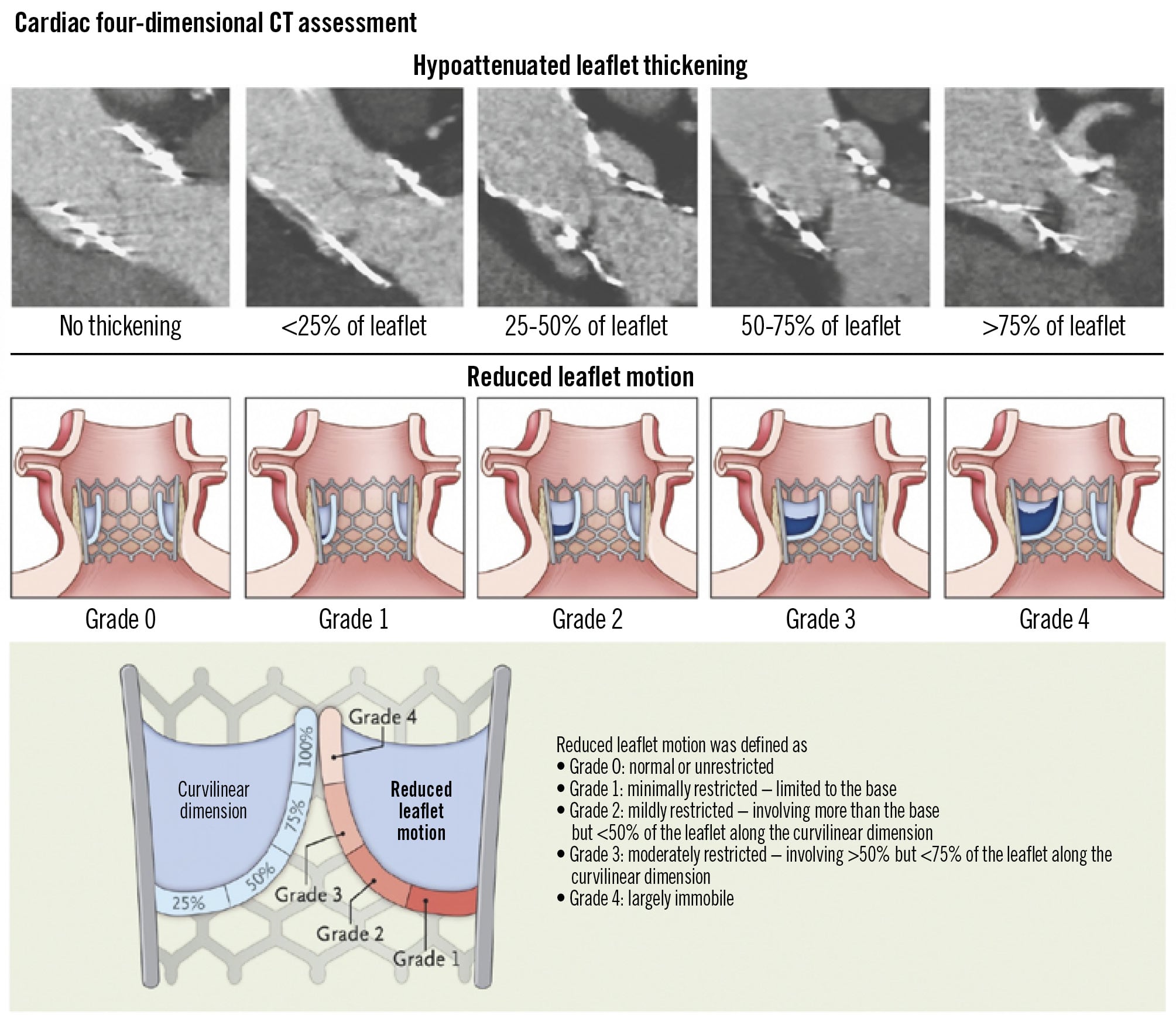 A new issue of EuroIntervention
