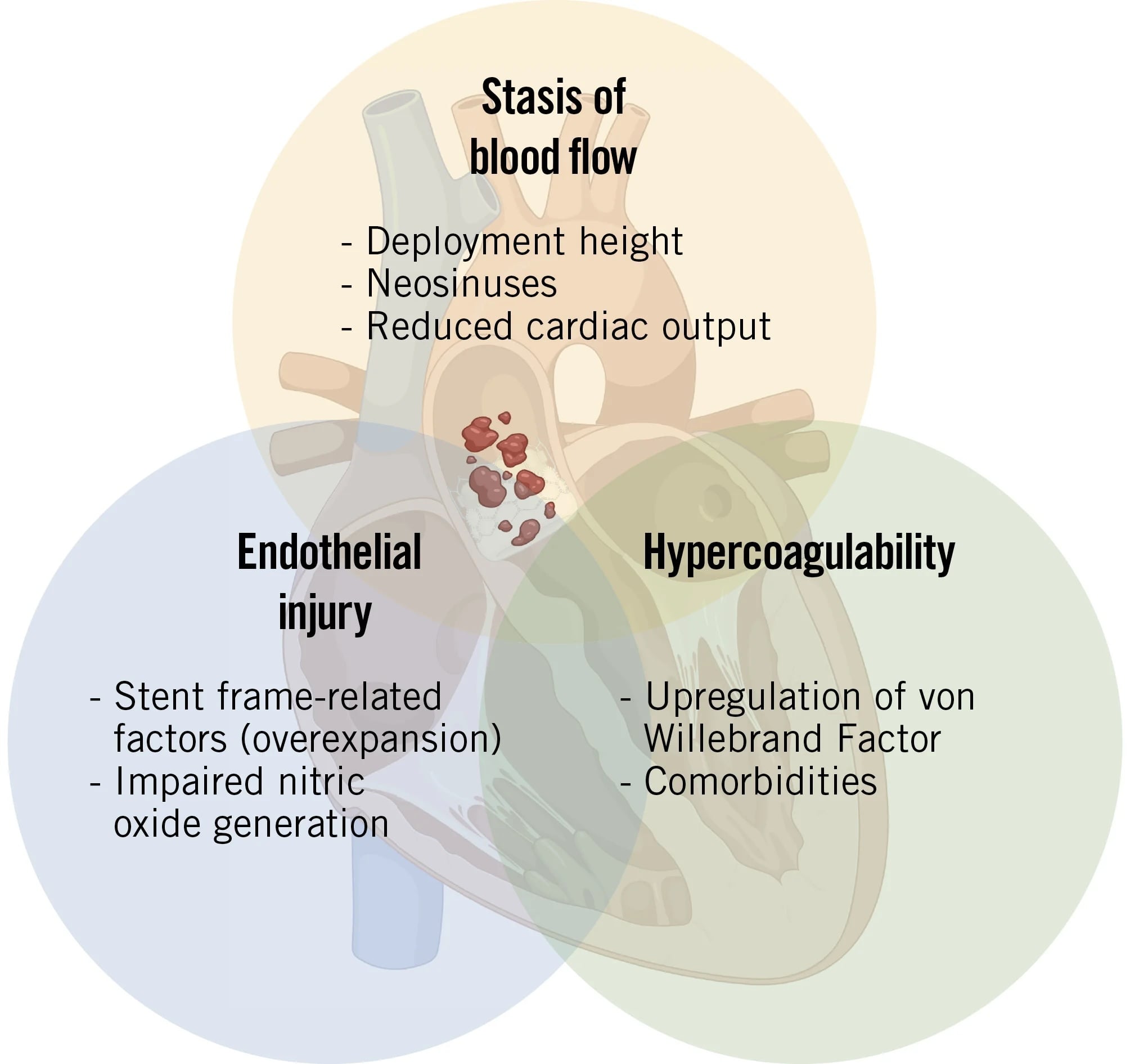 TAVI thrombosis
