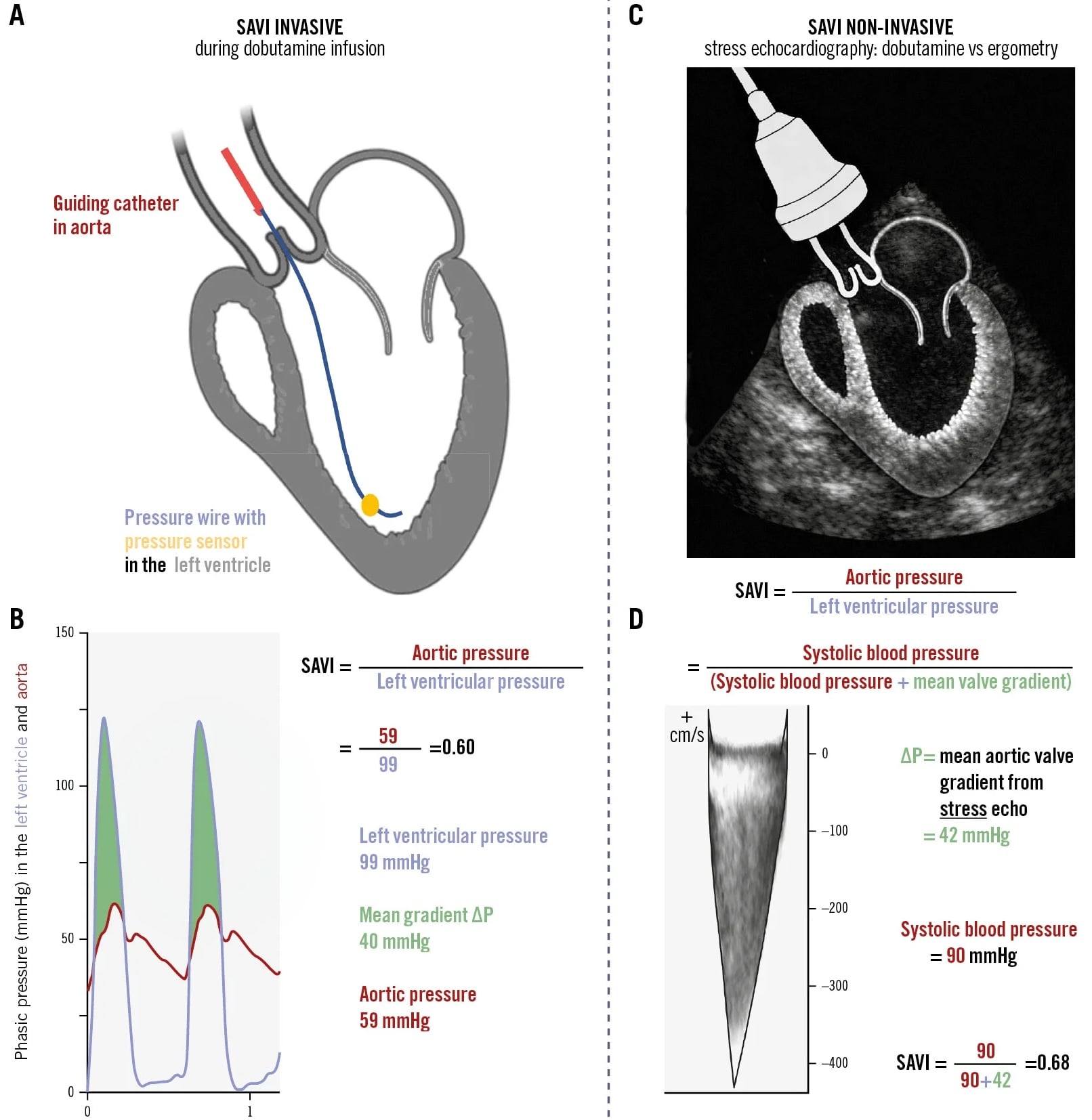 The SAVI-AoS trial
