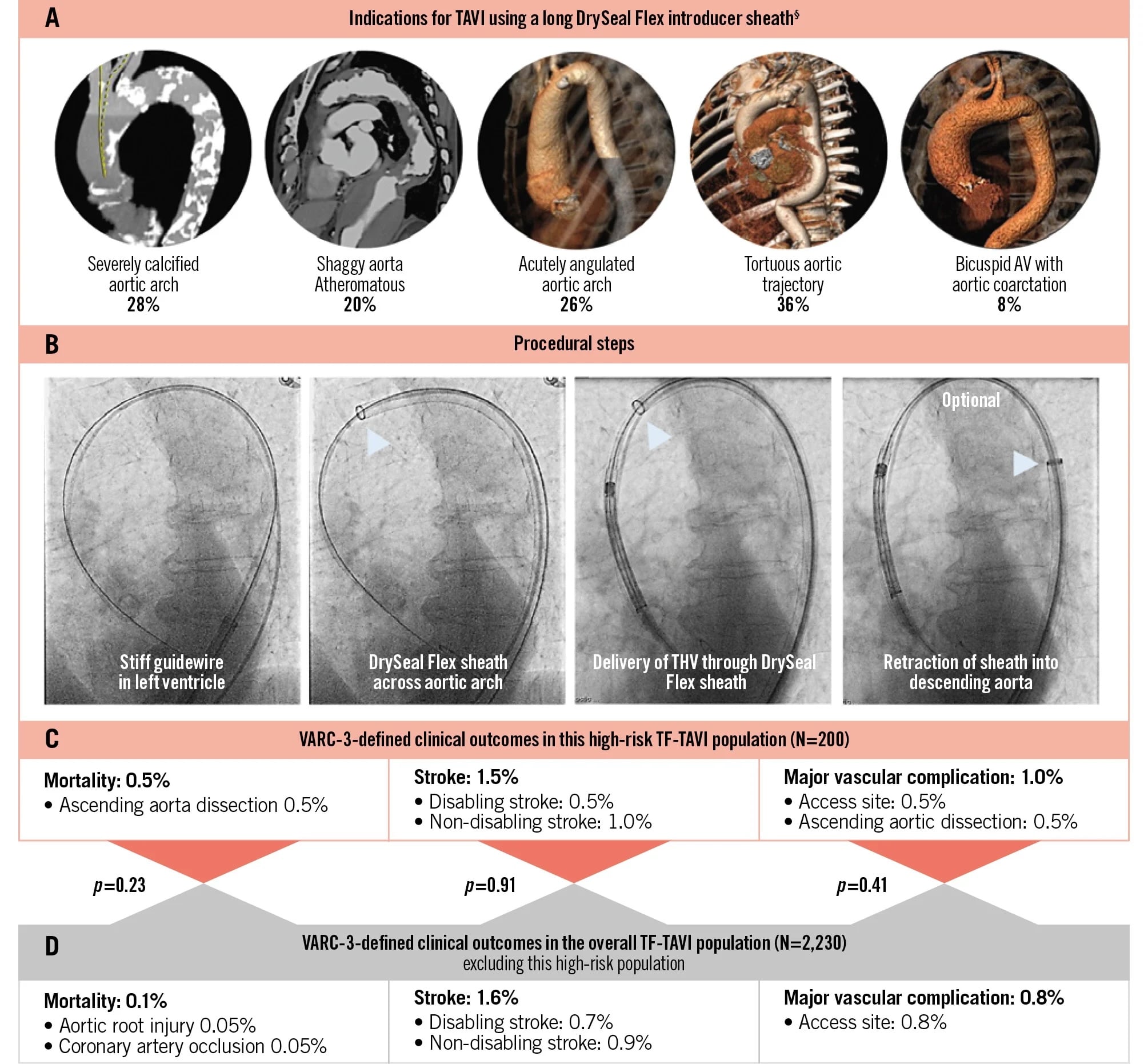 Extended-length introducer sheaths for TAVI