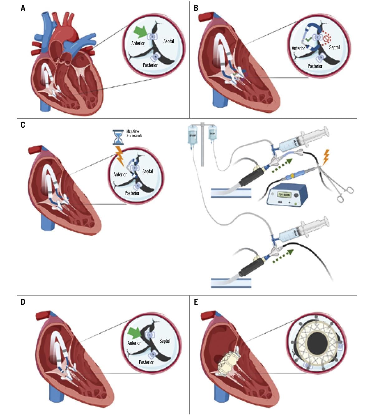 A new issue of EuroIntervention